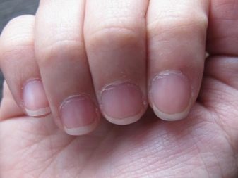 Bavuri: problema mâinilor si unghiilor. Metodele de elimenare - GlobalFashion