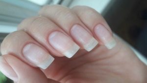 Como restaurar as unhas após goma-laca?