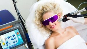 Ako často by ste si mali dať laserovú epiláciu?
