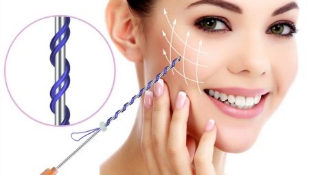 Hogyan kell helyesen használni a szálakat az arcplasztika során?
