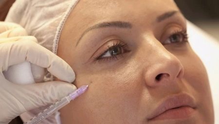 Mesoterapia facial: ¿que es y como se realiza?
