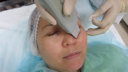 Peraturan untuk pembersihan muka ultrasonik