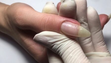 Funktioner av förlängningen av en trasig nagel