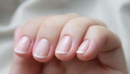 Cause e trattamento dell'infiammazione della cuticola delle unghie