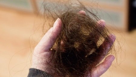 A haj csomókban hullik: okai és megoldása a problémára