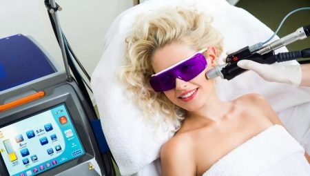 Wie oft sollte eine Laser-Haarentfernung durchgeführt werden?