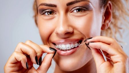 Cum să curățați și să îngrijiți dinții cu aparatul dentar?