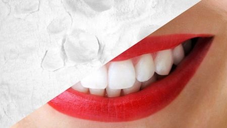 Hoe tanden bleken met folie?