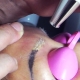 Jemnosti procesu laserového odstranění tetování obočí