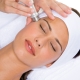 Microdermabrasion: features and procedure