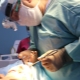 Mga tampok ng endoscopic face lifting procedure