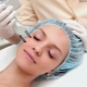 Laser facial rejuvenation: features, types and technology