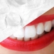 Wie kann man Zähne mit Folie aufhellen?