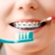 Totul despre periute de dinti pentru aparat dentar