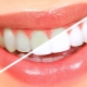Cách làm trắng răng tại nhà?