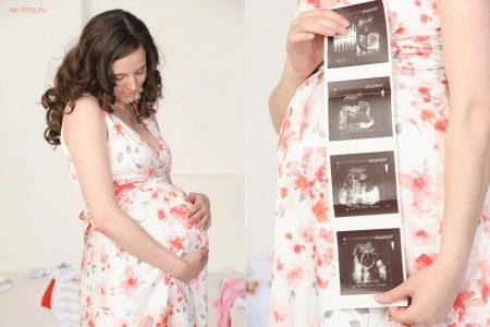 Foto di una donna incinta con l'ecografia